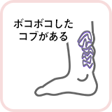 ボコボコしたコブがある
