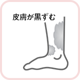 皮膚が黒ずむ